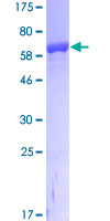 ENO1 / Alpha Enolase Protein - 12.5% SDS-PAGE of human ENO1 stained with Coomassie Blue