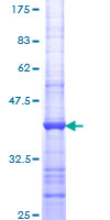 ENO1 / Alpha Enolase Protein - 12.5% SDS-PAGE Stained with Coomassie Blue.