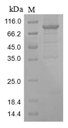 ENO1 / Alpha Enolase Protein - (Tris-Glycine gel) Discontinuous SDS-PAGE (reduced) with 5% enrichment gel and 15% separation gel.