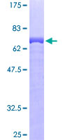 ENO2 / NSE Protein - 12.5% SDS-PAGE of human ENO2 stained with Coomassie Blue