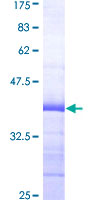 ENO2 / NSE Protein - 12.5% SDS-PAGE Stained with Coomassie Blue.