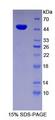 ENO2 / NSE Protein - Recombinant Enolase, Neuron Specific By SDS-PAGE