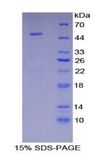 ENO2 / NSE Protein - Recombinant Enolase, Neuron Specific By SDS-PAGE