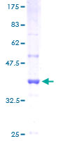 ENOPH1 / MASA Protein - 12.5% SDS-PAGE of human MASA stained with Coomassie Blue