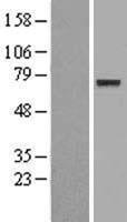 ENOX1 / CNOX Protein - Western validation with an anti-DDK antibody * L: Control HEK293 lysate R: Over-expression lysate