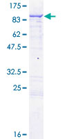 ENOX1 / CNOX Protein - 12.5% SDS-PAGE of human ENOX1 stained with Coomassie Blue