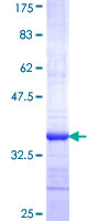 ENOX2 Protein - 12.5% SDS-PAGE Stained with Coomassie Blue.