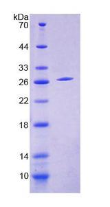ENOX2 Protein - Recombinant Cytosolic Ovarian Carcinoma Antigen 1 By SDS-PAGE