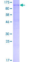 ENPP1 Protein - 12.5% SDS-PAGE of human ENPP1 stained with Coomassie Blue