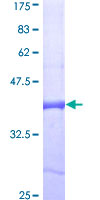 ENPP1 Protein - 12.5% SDS-PAGE Stained with Coomassie Blue.