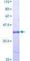 ENPP1 Protein - 12.5% SDS-PAGE Stained with Coomassie Blue.