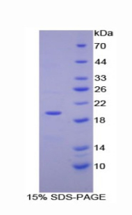 ENPP1 Protein - Recombinant Ectonucleotide Pyrophosphatase/Phosphodiesterase 1 By SDS-PAGE