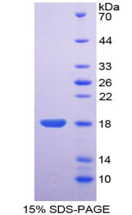 ENPP1 Protein - Recombinant Ectonucleotide Pyrophosphatase/Phosphodiesterase 1 By SDS-PAGE