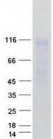 ENPP1 Protein - Purified recombinant protein ENPP1 was analyzed by SDS-PAGE gel and Coomassie Blue Staining