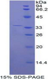 ENPP2 / Autotaxin Protein - Recombinant Ectonucleotide Pyrophosphatase/Phosphodiesterase 2 By SDS-PAGE