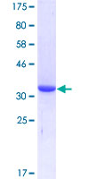 ENPP3 / CD203c Protein - 12.5% SDS-PAGE Stained with Coomassie Blue.