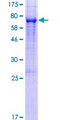 ENPP4 Protein - 12.5% SDS-PAGE of human ENPP4 stained with Coomassie Blue
