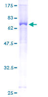ENPP5 Protein - 12.5% SDS-PAGE of human ENPP5 stained with Coomassie Blue