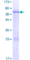 ENPP6 Protein - 12.5% SDS-PAGE of human ENPP6 stained with Coomassie Blue
