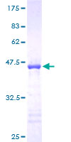 ENSA Protein - 12.5% SDS-PAGE of human ENSA stained with Coomassie Blue