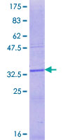 ENTPD2 Protein - 12.5% SDS-PAGE Stained with Coomassie Blue.
