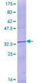 ENTPD2 Protein - 12.5% SDS-PAGE Stained with Coomassie Blue.
