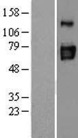 ENTPD3 Protein - Western validation with an anti-DDK antibody * L: Control HEK293 lysate R: Over-expression lysate
