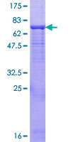 ENTPD3 Protein - 12.5% SDS-PAGE of human ENTPD3 stained with Coomassie Blue