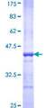 ENTPD3 Protein - 12.5% SDS-PAGE Stained with Coomassie Blue.