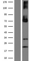ENTPD4 / LALP70 Protein - Western validation with an anti-DDK antibody * L: Control HEK293 lysate R: Over-expression lysate