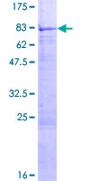 ENTPD4 / LALP70 Protein - 12.5% SDS-PAGE of human ENTPD4 stained with Coomassie Blue