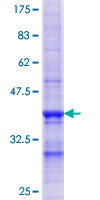 ENTPD4 / LALP70 Protein - 12.5% SDS-PAGE Stained with Coomassie Blue.