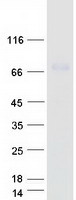 ENTPD4 / LALP70 Protein - Purified recombinant protein ENTPD4 was analyzed by SDS-PAGE gel and Coomassie Blue Staining