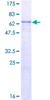 ENTPD5 / CD39L4 Protein - 12.5% SDS-PAGE of human ENTPD5 stained with Coomassie Blue