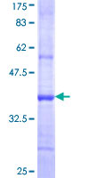 ENTPD5 / CD39L4 Protein - 12.5% SDS-PAGE Stained with Coomassie Blue.