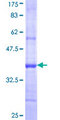 ENTPD5 / CD39L4 Protein - 12.5% SDS-PAGE Stained with Coomassie Blue.