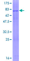 ENTPD6 Protein - 12.5% SDS-PAGE of human ENTPD6 stained with Coomassie Blue