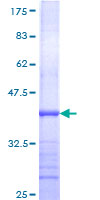 ENTPD6 Protein - 12.5% SDS-PAGE Stained with Coomassie Blue.