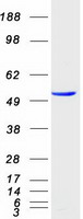 ENTPD6 Protein - Purified recombinant protein ENTPD6 was analyzed by SDS-PAGE gel and Coomassie Blue Staining