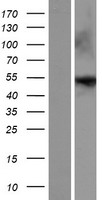 ENTPD8 Protein - Western validation with an anti-DDK antibody * L: Control HEK293 lysate R: Over-expression lysate