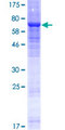 ENTPD8 Protein - 12.5% SDS-PAGE of human ENTPD8 stained with Coomassie Blue