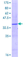 ENTPD8 Protein - 12.5% SDS-PAGE Stained with Coomassie Blue.