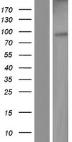 EnvR / ERV3 Protein - Western validation with an anti-DDK antibody * L: Control HEK293 lysate R: Over-expression lysate