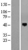 EOGT Protein - Western validation with an anti-DDK antibody * L: Control HEK293 lysate R: Over-expression lysate