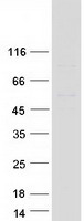 EOGT Protein - Purified recombinant protein EOGT was analyzed by SDS-PAGE gel and Coomassie Blue Staining