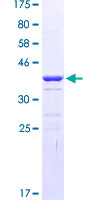 Eomesodermin / EOMES Protein - 12.5% SDS-PAGE Stained with Coomassie Blue