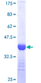 Eomesodermin / EOMES Protein - 12.5% SDS-PAGE Stained with Coomassie Blue