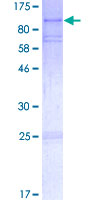 Eosinophil Peroxidase / EPX Protein - 12.5% SDS-PAGE of human EPX stained with Coomassie Blue