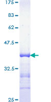 EP300 / p300 Protein - 12.5% SDS-PAGE Stained with Coomassie Blue.
