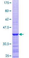 EP400 / p400 Protein - 12.5% SDS-PAGE Stained with Coomassie Blue.